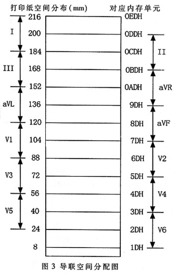 為各個導聯分配的熱敏打印紙空間與緩沖內存單元