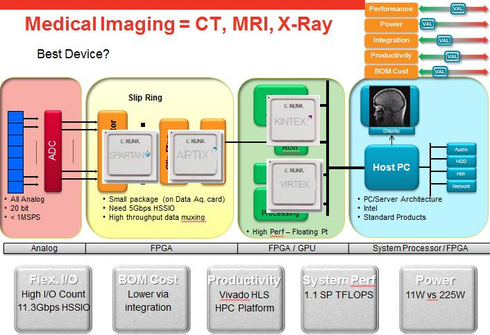 Xilinx 7系列FPGA在醫(yī)療成像方面的應(yīng)用