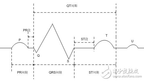 圖1.1 標準心電信號的波形組成