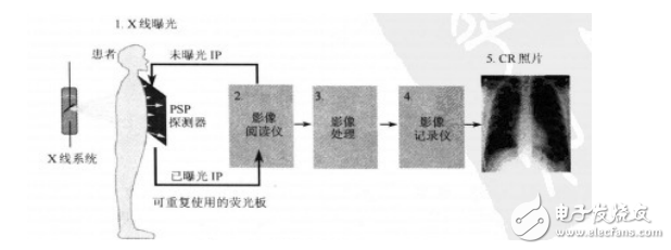 CR成像系統的構造與成像原理分析