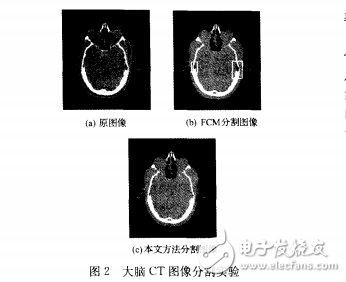 基于FCM聚類算法的新型圖像分割算法分析