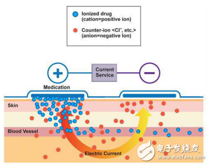 另一種基于MCU的給藥設備