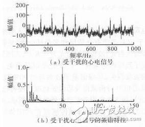 心電信號檢測中濾除肌電干擾的方法解析