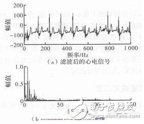 心電信號檢測中濾除肌電干擾的方法解析