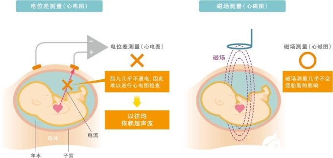 MR生物磁性傳感器的特點以及各種應用解析